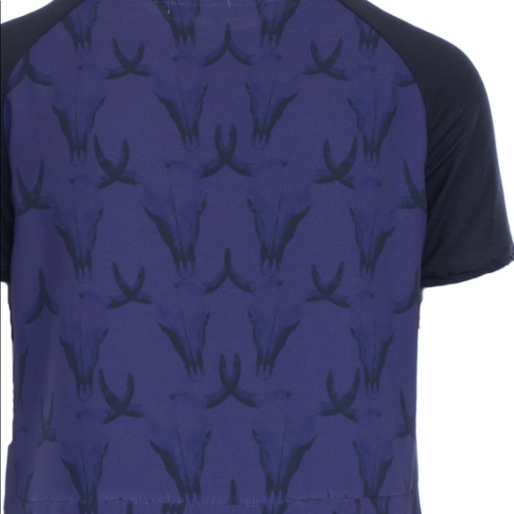 House of Harlow ramshead pocket Adeline dress NWT - Picture 5 of 8